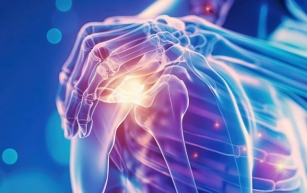 Treatments Strategies for Rheumatoid Arthritis