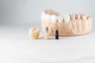 Step-By-Step: Finding The Right Dental Treatment For You