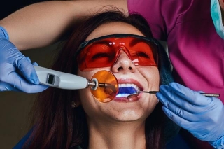 What Happens During Zoom Teeth Whitening?