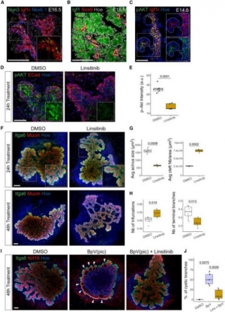 Acinar-Ductal Cell Rearrangement Drives Branching Morphogenesis Of The Murine Pancreas In An IGF/PI3K Dependent Manner