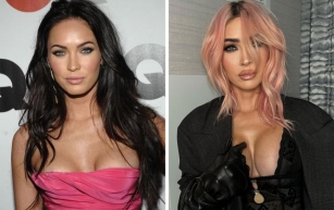 26 Celebrities Before And After Plastic Surgery, Kim Kardashian And Ariana Grande Included