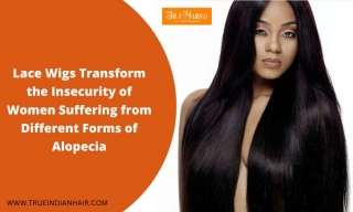 How Lace Wigs Transform The Insecurity Of Women Suffering From Different Forms Of Alopecia