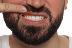 Understanding Gum Disease: Everything You Need To Know