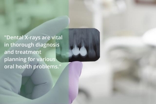 X-Ray Insight: The Importance Of Dental Imaging