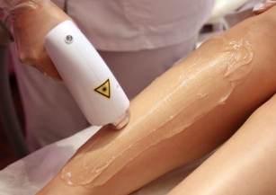 5 Reasons Laser Is The Best Hair Removal Method| Laser Hair Removal