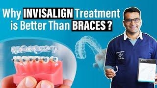 Invisible Aligners Or Metal Wires? The Choice For Straight Teeth