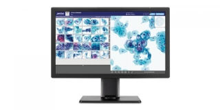 Hologic’s Genius Digital Diagnostics System, A New Digital Cytology Development