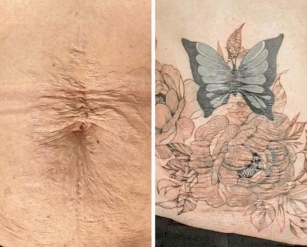 Tattoos That Help Turn Your Scars Into Something Beautiful