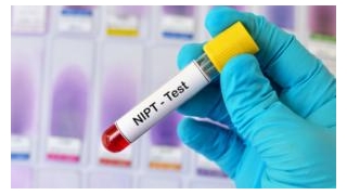 Which NIPT Test During Pregnancy Is The Best?
