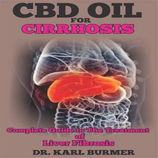 CBD Oil In Cirrhosis: Complete Guide To The Treatment Of Liver Fibrosis