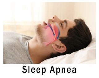 Best Sleeping Positions For Sleep Apnea: How To Improve Your Sleep Quality