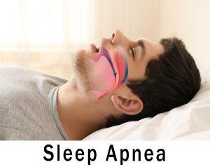 How to Win Sleep Apnea VA Claim: Insider Tips and Steps