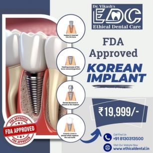 Discover The Best Dental Implant Dentist In Noida