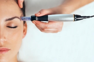 Dermapen Vs. Derma Roller: Ultimate Microneedling Face-Off For Flawless Skin