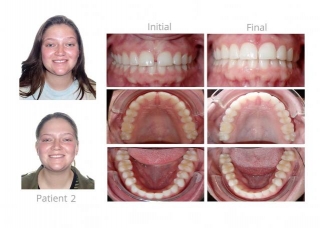 Orthodontic Arts Welcomes Displaced Smile Direct Club Users With Personalized Care And Proven Results