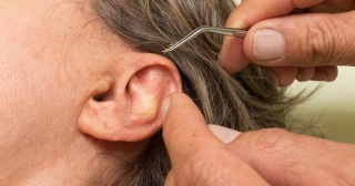 The Sound Of Silence: How Ear Wax Impacts Your Hearing