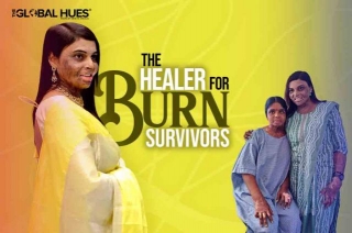Neehaari Mandali: The Healer For Burn Survivors