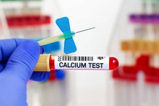 What Is The Importance Of A Calcium Test For Health