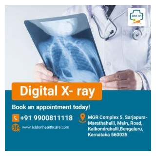 Digital X-ray Near Sarjapur Road Bangalore