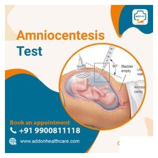 Amniocentesis Test Near Sarjapur Road Bangalore