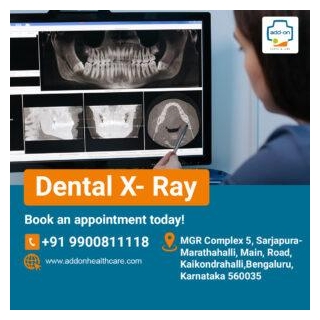Dental X-Ray Near Sarjapur Road Bangalore
