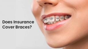 Can Insurance Cover Braces