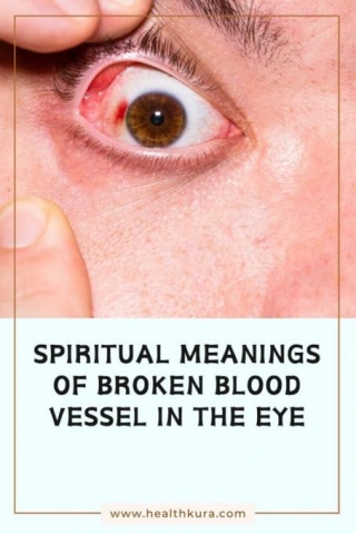 Spiritual Meanings Of Broken Blood Vessel In The Eye