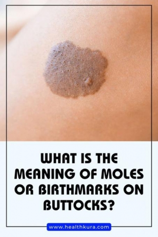 9 Meanings Of Moles Or Birthmarks On Buttocks [Females & Males]