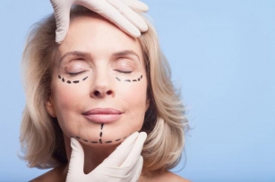 HSA And Cosmetic Surgery: FAQs | BerniePortal