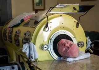 Polio Paul, Renowned For Life In Mechanical Chamber, Dies At 78