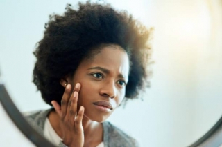 It Looks Different On Us: 5 Signs Of HS On Black Skin