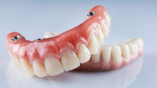 Can Dental Implants Get Cavities?
