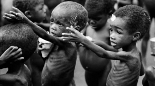 There Is Severe Malnourished Children In Seven Northern States – MSF