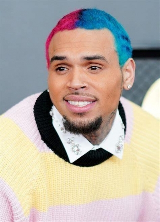 Chris Brown Hair Transplant: Did He Really Get It?