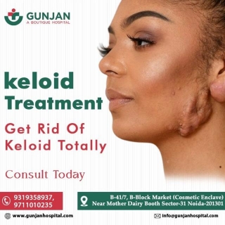 Say Goodbye To Keloids And Hello To Flawless Skin With Gunjan Hospital!