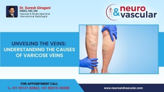 Unveiling The Veins: Understanding The Causes Of Varicose Veins