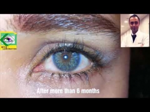 Changing Your Eye Color Tips