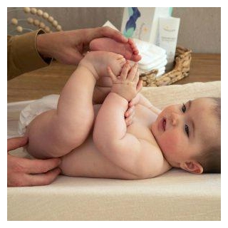 Baby Diaper Rash Cream Market Will Hit Big Revenues In Future | Pigeon, Sudocrem, Drapolene