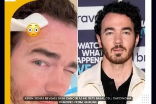 Kevin Jonas Undergoes Skin Cancer Removal, Encourages Fans To Get Checked