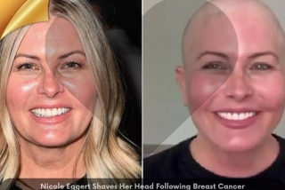 Nicole Eggert Shaves Her Head Following Breast Cancer Diagnosis