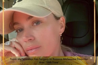 Teddi Mellencamp Has Surgery To Remove Melanoma From Her Arm: '15th Time'