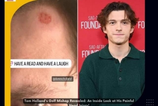 Tom Holland's Golf Mishap Revealed: An Inside Look At His Painful Head Injury!