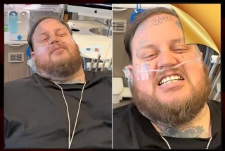 Jelly Roll Feels 'Sexy' As He Undergoes Several 'Reconstructive' Oral Procedures: 'I Want A Pretty Smile'