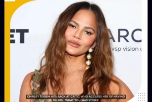 Chrissy Teigen Claps Back At Critic Over Fillers Rumors Revealed Truth