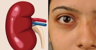 Kidney And Eyes