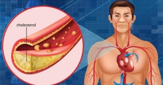 Cholesterol In The Body