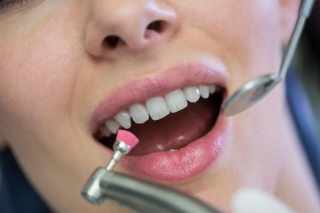 What Is A Fluoride Treatment?
