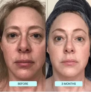 Skynpure Reviews 2024: Do These Collagen Films Work?