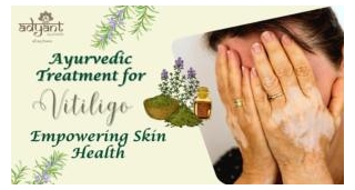 Ayurvedic Treatment For Vitiligo: Types, Remedies, Causes, Benefits