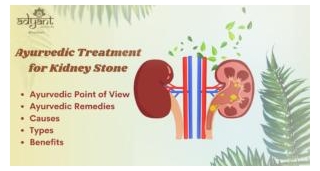Ayurvedic Treatments For Kidney Stone: Types, Remedies, Causes, & Diet